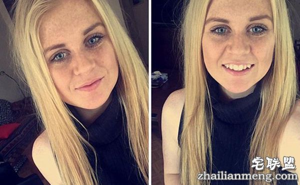 女孩得了“睡美人综合征” 一次可以睡十天