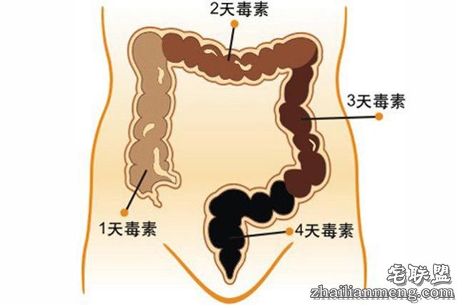 实用贴!怎样清理宿便?这10个办法都排干净