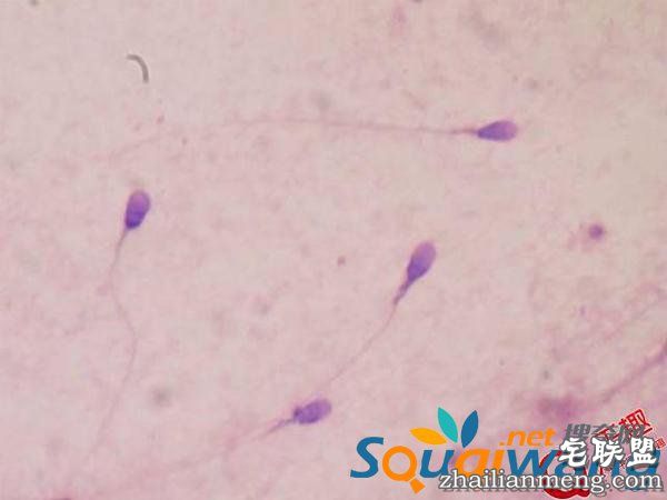 关于性的一些冷知识！精液可以治疗抑郁？