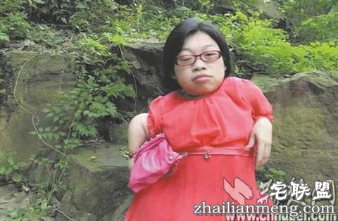 89厘米高瓷娃娃怀孕当妈 专家:这样当妈赌注太大