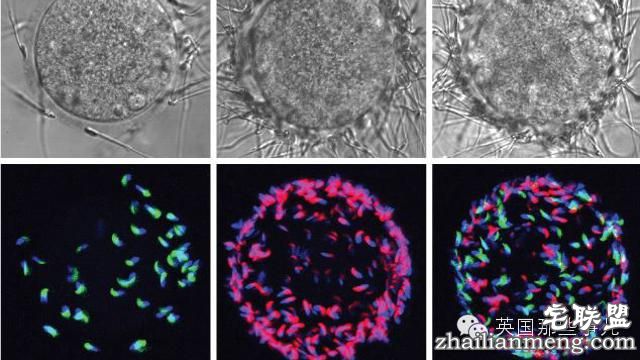 用假卵子勾引精子...科学家们又发明了避孕新套路