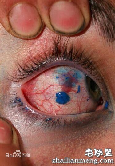 变态尝试,纹眼球 网友:真是大开眼