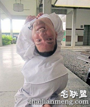 奇迹！畸形男：活着就能改变全球