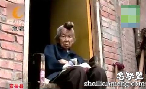 87岁老太头上长出13cm长“独角”让人称奇