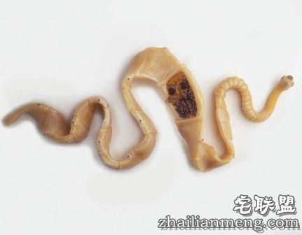 女子吃带血丝牛排 体内竟长出2.5米长绦虫！