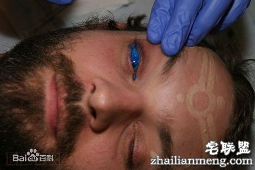 变态尝试,纹眼球 网友:真是大开眼