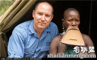 吓人!全球上最大的唇盘 称嘴大陪嫁的牛畜越多！