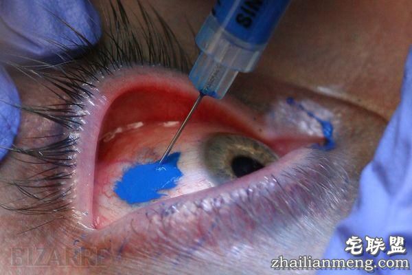 变态尝试,纹眼球 网友:真是大开眼