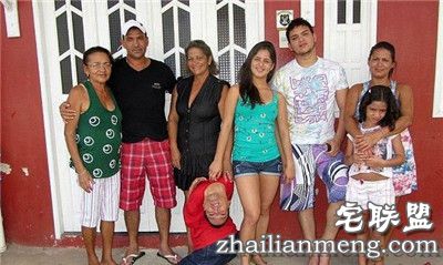 奇迹！畸形男：活着就能改变全球