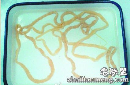 女子吃带血丝牛排 体内竟长出2.5米长绦虫！