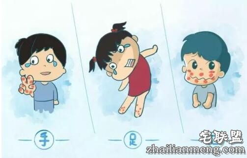 香港爆发手足口病 手足口病初期症状及预防