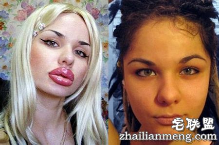 尴尬!男子把女友吻成香肠嘴网友:谁让你们秀恩爱