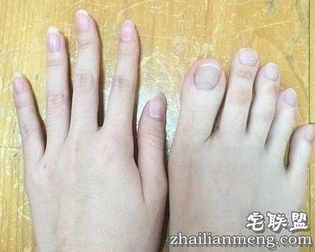 女大学生脚趾修长如手指 可以轻松用脚趾写字