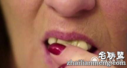 女子害怕看牙医，牙掉了用502胶水粘住，医牙竟把全副身家搭进