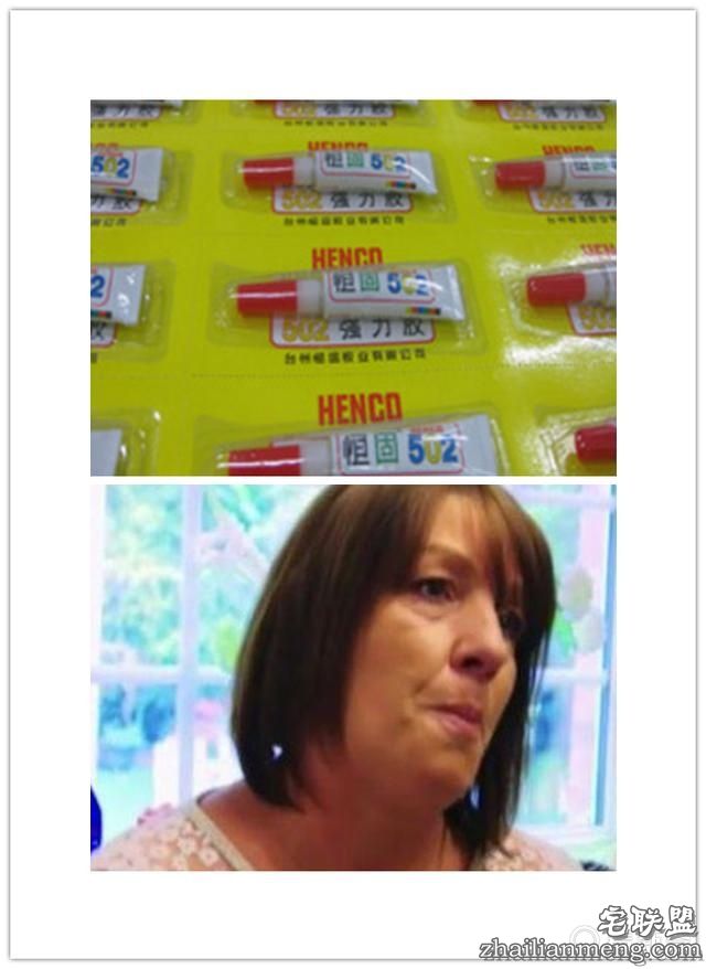 女子害怕看牙医，牙掉了用502胶水粘住，医牙竟把全副身家搭进