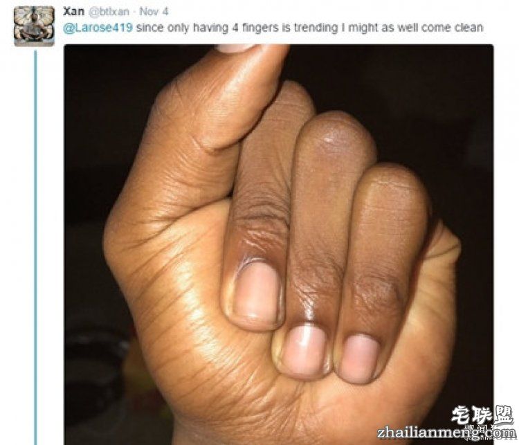 大家以为她天生4根手指，真相让这个手势一夜流行