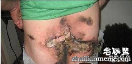 天天放屁，你却不知道的10个“屁知识”！