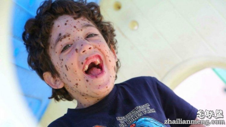 8岁男孩脸上长满胎记被嘲笑，网友的反应好有爱