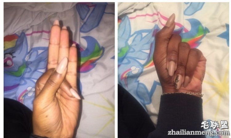 大家以为她天生4根手指，真相让这个手势一夜流行