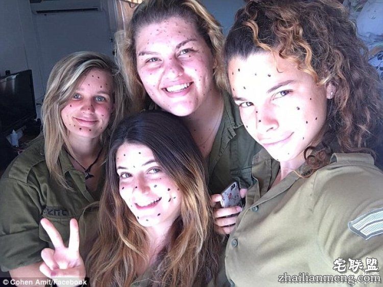 8岁男孩脸上长满胎记被嘲笑，网友的反应好有爱