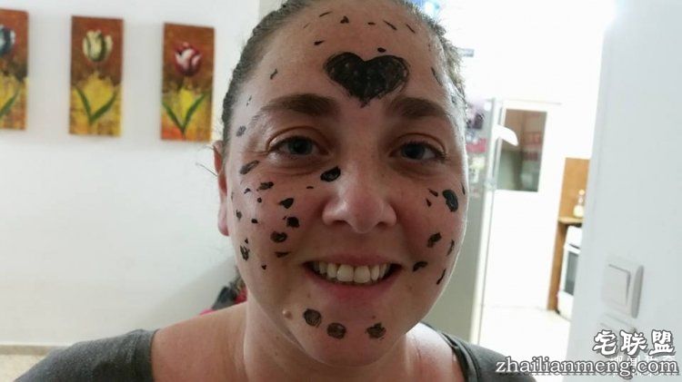 8岁男孩脸上长满胎记被嘲笑，网友的反应好有爱