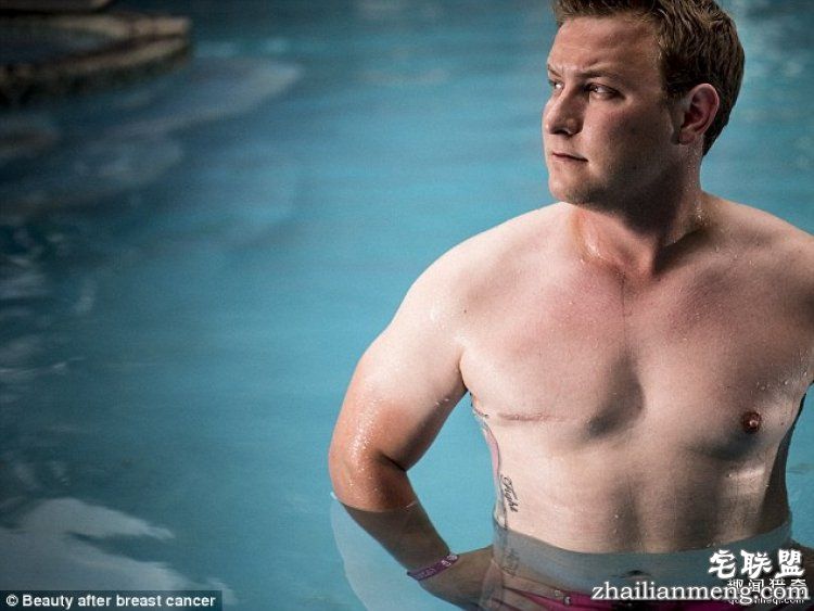 她花3年为乳腺癌幸存者拍下照片，有男人有女人