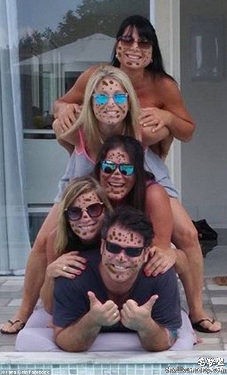 8岁男孩脸上长满胎记被嘲笑，网友的反应好有爱