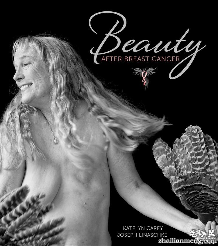 她花3年为乳腺癌幸存者拍下照片，有男人有女人