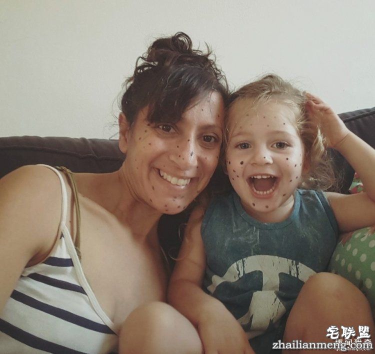 8岁男孩脸上长满胎记被嘲笑，网友的反应好有爱