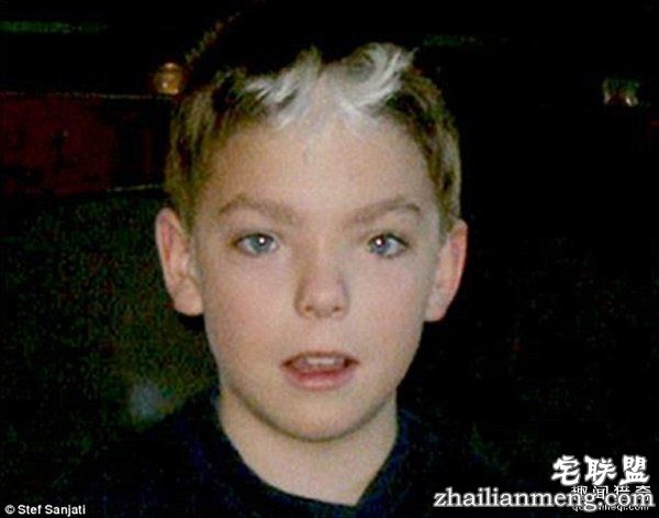 20岁小伙众筹22万变性：术后照片惊艳