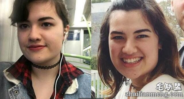 18岁少女坚持要绝育 原因是：生小孩会危害环境