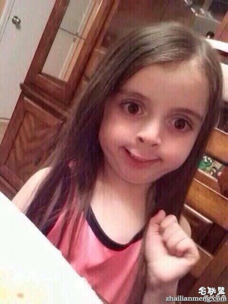 被吸尘器打断，被医生掰折…18位网友分享他们奇葩的骨折原因