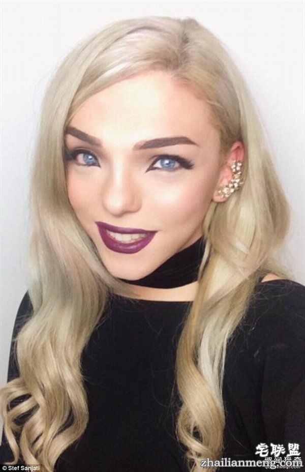 20岁小伙众筹22万变性：术后照片惊艳