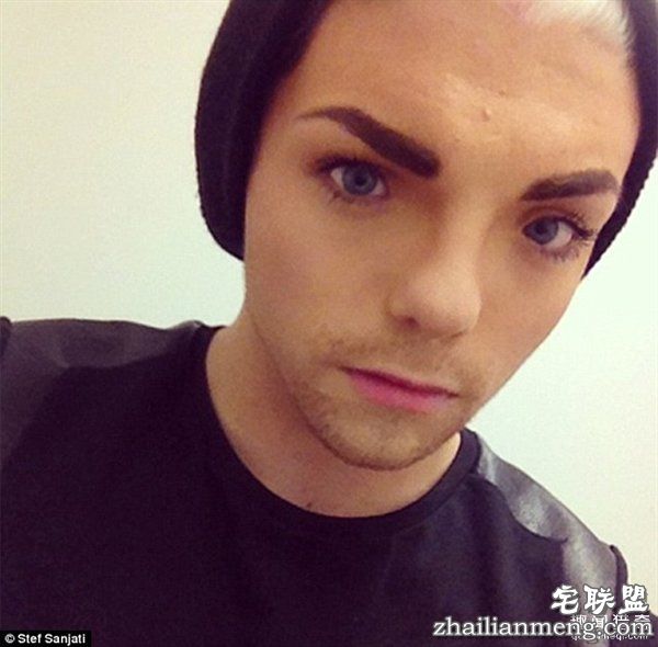 20岁小伙众筹22万变性：术后照片惊艳