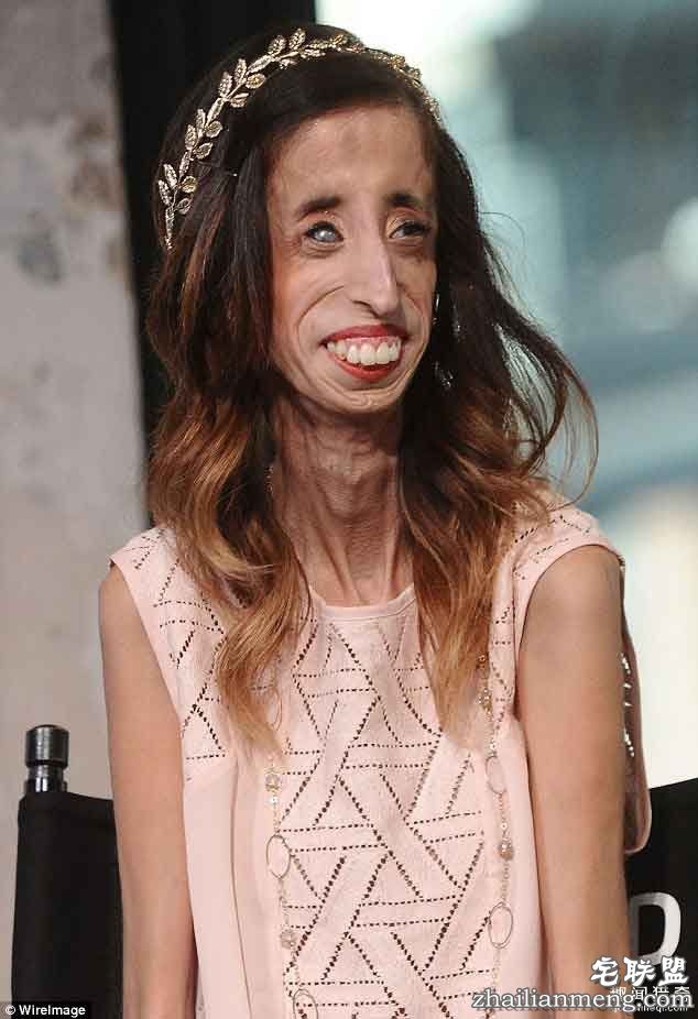 丽兹（Lizzie Velasquez）