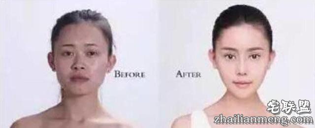 女孩花百万变身“重庆版Angelababy”，整容前后对比，惊呆了！！！