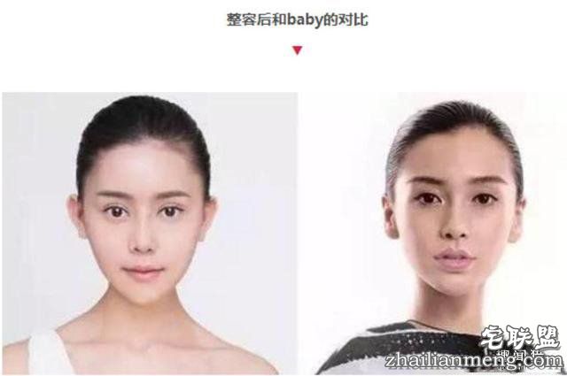 女孩花百万变身“重庆版Angelababy”，整容前后对比，惊呆了！！！