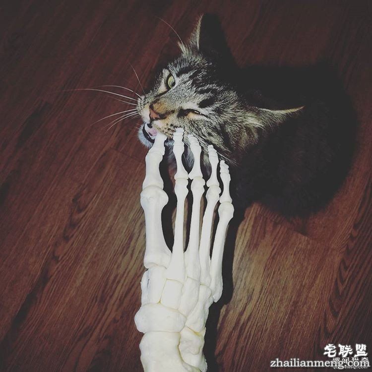 女孩被截肢后，天天拿着自己的脚骨自拍