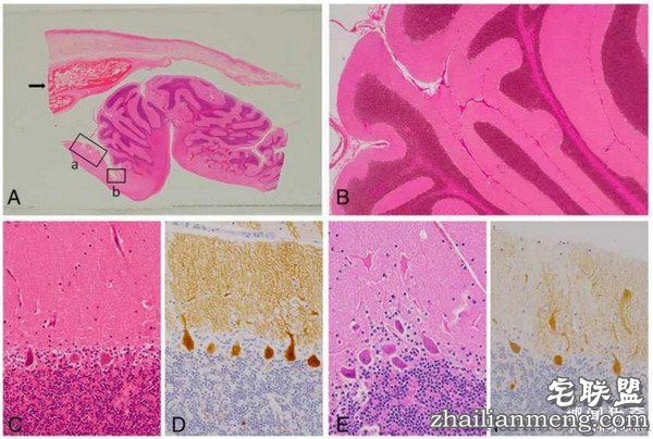 16岁女孩肚子里长出“第二个脑袋”，还能传导神经信号...