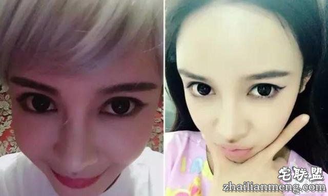 女孩花百万变身“重庆版Angelababy”，整容前后对比，惊呆了！！！