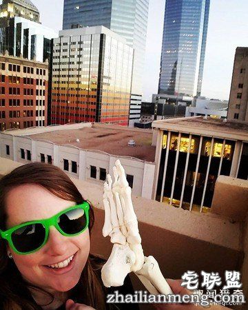 女孩被截肢后，天天拿着自己的脚骨自拍