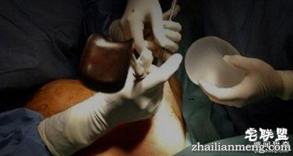 韩国女子隆胸5年假体破裂 硅胶随母乳流出被孩子吃下