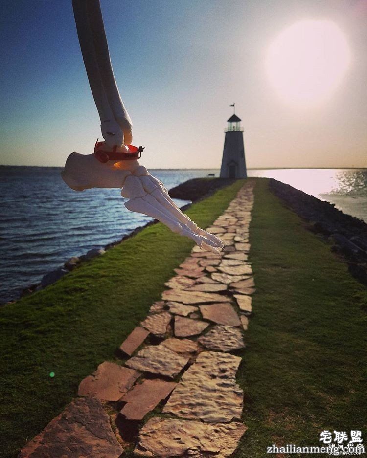 女孩被截肢后，天天拿着自己的脚骨自拍