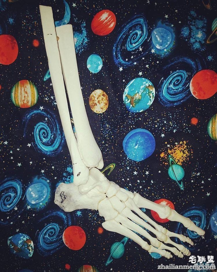 女孩被截肢后，天天拿着自己的脚骨自拍