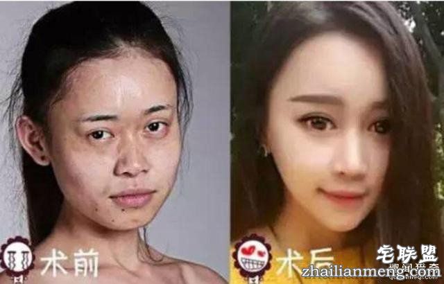 女孩花百万变身“重庆版Angelababy”，整容前后对比，惊呆了！！！