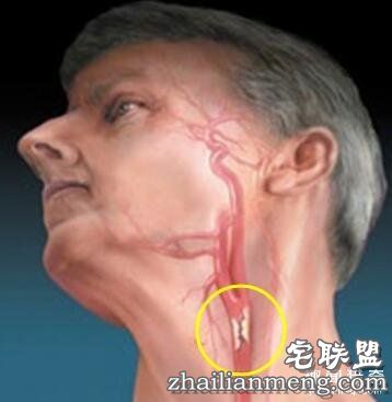 身体有6个“死穴”，伤到它们很危险！