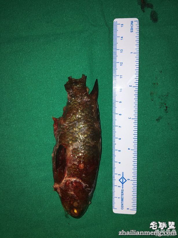 男子「活鱼卡喉咙」痛苦快死，医生「拉出整条画面」大傻眼!